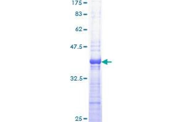 PRKAR1A Protein (AA 1-100) (GST tag)