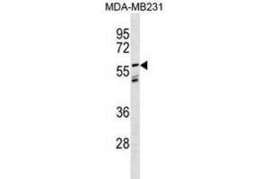Western Blotting (WB) image for anti-Leucine-Rich Repeat LGI Family, Member 3 (LGI3) antibody (ABIN3000958) (LGI3 Antikörper)