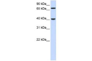 Western Blotting (WB) image for anti-PDZ and LIM Domain 3 (PDLIM3) antibody (ABIN2459845)