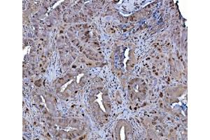 IHC analysis of MCM4 using anti-MCM4 antibody (ABIN7601485). (MCM4 Antikörper  (AA 361-677))