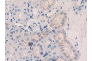 Used in DAB staining on fromalin fixed paraffin- embedded kidney tissue (CTSA Antikörper  (AA 215-470))