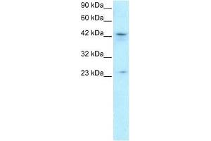 ZNF365 antibody used at 1. (ZNF365 Antikörper  (N-Term))