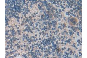 Immunohistochemistry (IHC) image for anti-Lipocalin 6 (LCN6) (AA 28-187) antibody (ABIN7443488)