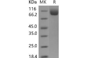 Western Blotting (WB) image for N-Acetylated alpha-Linked Acidic Dipeptidase-Like 1 (NAALADL1) protein (His tag) (ABIN7320106) (NAALADL1 Protein (His tag))