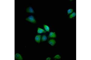 Immunofluorescence staining of Hela cells with ABIN7155168 at 1:66, counter-stained with DAPI. (PDE8B Antikörper  (AA 18-110))
