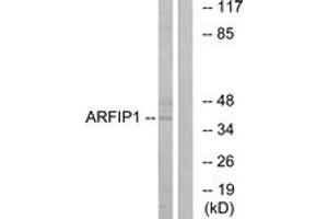 Western blot analysis of extracts from Jurkat cells, using ARFIP1 Antibody.