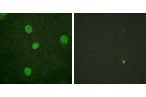P-peptide - +Western blot analysis of extracts from K562 cells, using B-Myb (Phospho-Ser577/581) antibody. (MYBL2 Antikörper  (pSer577, pSer581))