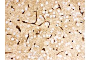 Immunohistochemistry (IHC) image for anti-Solute Carrier Family 2 (Facilitated Glucose Transporter), Member 1 (SLC2A1) (AA 92-492) antibody (ABIN3043927)