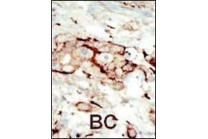 Immunohistochemistry (Paraffin-embedded Sections) (IHC (p)) image for anti-Fibroblast Growth Factor Receptor 2 (FGFR2) (AA 22-51), (N-Term) antibody (ABIN391965)