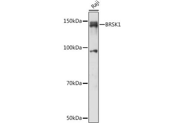 BRSK1 Antikörper  (AA 310-510)