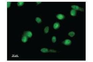Immunostaining analysis in HeLa cells. (LMO1 Antikörper)