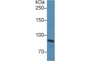 Western Blotting (WB) image for anti-Cadherin 1, Type 1, E-Cadherin (Epithelial) (CDH1) (AA 374-628) antibody (ABIN1858333)