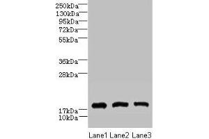 Western blot All lanes: CNIH2 antibody at 2 μg/mL Lane 1: U251 whole cell lysate Lane 2: Mouse liver tissue Lane 3: Mouse kidney tissue Secondary Goat polyclonal to rabbit IgG at 1/10000 dilution Predicted band size: 19 kDa Observed band size: 19 kDa (CNIH2 Antikörper  (AA 94-138))