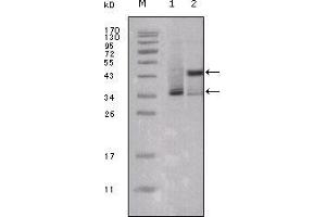 Western blot analysis using ESR1 mouse mAb against truncated ESR1-His recombinant protein (1) and truncated Trx-ESR1 recombinant protein (2). (Estrogen Receptor alpha Antikörper  (AA 301-595))