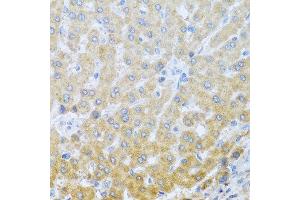 Immunohistochemistry of paraffin-embedded human liver using IL20 antibody at dilution of 1:100 (40x lens). (IL-20 Antikörper)