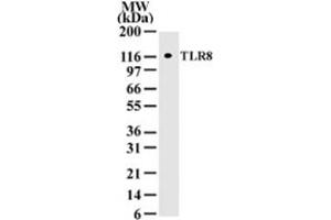 Western blot analysis of TLR8 in cell lysates from 293 transfected with human TLR8. (TLR8 Antikörper  (AA 750-850))