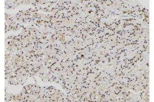 ABIN6276875 at 1/100 staining Human lung tissue by IHC-P. (MX1 Antikörper  (C-Term))