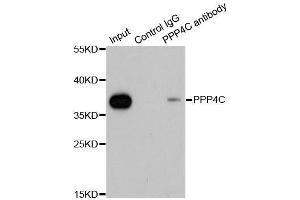 Immunoprecipitation analysis of 200ug extracts of 293T cells using 1ug PPP4C antibody. (PPP4C Antikörper  (AA 1-307))
