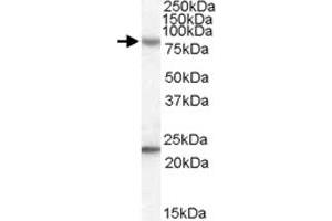 DHX58 polyclonal antibody  (0. (DHX58 Antikörper)