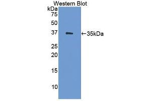 Detection of Recombinant HSD17b1, Human using Polyclonal Antibody to 17-Beta-Hydroxysteroid Dehydrogenase Type 1 (HSD17b1)