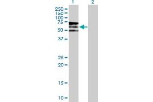 Western Blot analysis of PIP5K3 expression in transfected 293T cell line by PIP5K3 MaxPab polyclonal antibody. (PIKFYVE Antikörper  (AA 1-451))