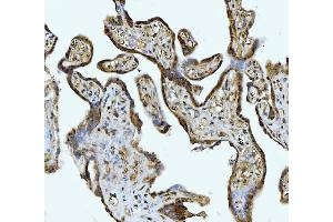 IHC analysis of ACLY using anti-ACLY antibody (ABIN4886416). (ACLY Antikörper  (AA 1-180))