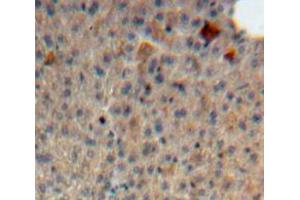Used in DAB staining on fromalin fixed paraffin-embedded Liver tissue (Syndecan 1 Antikörper  (AA 23-255))