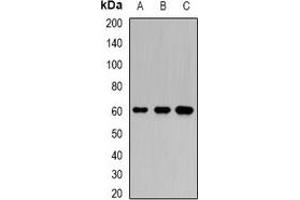 Western blot analysis of Karyopherin alpha-6 expression in BT474 (A), SW620 (B), mouse testis (C) whole cell lysates. (KPNA6 Antikörper)