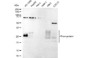 Western blotting analysis using Prion Protein antibody (ABIN7799898).