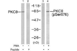 Image no. 2 for anti-Protein Kinase C, theta (PRKCQ) (pSer676) antibody (ABIN197071) (PKC theta Antikörper  (pSer676))