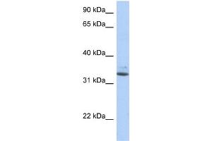 Western Blotting (WB) image for anti-Sulfotransferase Family, Cytosolic, 1A, Phenol-Preferring, Member 1 (SULT1A1) (N-Term) antibody (ABIN2783656)
