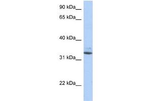 WB Suggested Anti-SULT1A1 Antibody Titration:  0.