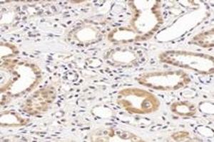 Immunohistochemistry (Paraffin-embedded Sections) (IHC (p)) image for anti-NCK Associated Protein 1 (NCKAP1) antibody (ABIN7074784)