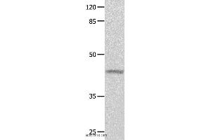 Western blot analysis of Mouse eyes tissue, using GNA11 Polyclonal Antibody at dilution of 1:550 (GNA11 Antikörper)