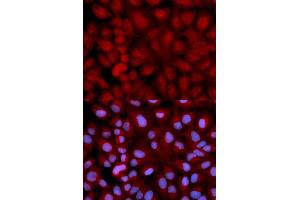 Immunofluorescence analysis of U2OS cell using SNCG antibody. (SNCG Antikörper  (AA 1-127))