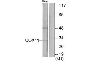 Western blot analysis of extracts from RAW264. (COX11 Antikörper)