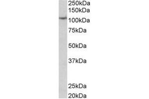 AP31571PU-N (0. (Thyroperoxidase Antikörper  (C-Term))