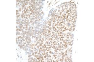 anti-PHD Finger Protein 8 (PHF8) (AA 650-700) antibody