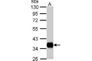WB Image Pyruvate Dehydrogenase E1 beta subunit antibody detects PDHB protein by Western blot analysis. (PDHE1-B Antikörper)