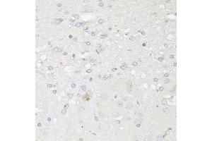 Immunohistochemistry of paraffin-embedded rat brain using CASP3 antibody. (Caspase 3 Antikörper  (AA 55-160))