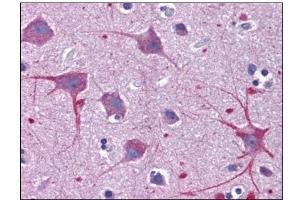Human Brain, Cortex: Formalin-Fixed, Paraffin-Embedded (FFPE) (SKA1 Antikörper  (C-Term))