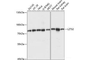 Western blot analysis of extracts of various cell lines using LZTS2 Polyclonal Antibody at dilution of 1:1000. (LZTS2 Antikörper)