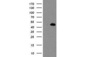 Western Blotting (WB) image for anti-Aryl Hydrocarbon Receptor Interacting Protein-Like 1 (AIPL1) antibody (ABIN1496508) (AIPL1 Antikörper)