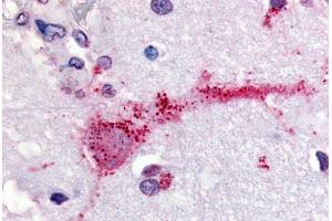 Human Brain (formalin-fixed, paraffin-embedded) stained with GPR3 antibody ABIN213338 at 40 ug/ml followed by biotinylated goat anti-rabbit IgG secondary antibody ABIN481713, alkaline phosphatase-streptavidin and chromogen. (GPR3 Antikörper  (Extracellular Domain))