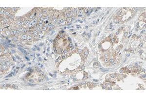 ABIN6268943 at 1/100 staining Human prostate tissue by IHC-P. (TRAF1 Antikörper  (C-Term))