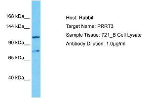 Host: Rabbit Target Name: PRRT3 Sample Type: 721_B Whole Cell lysates Antibody Dilution: 1. (PRRT3 Antikörper  (C-Term))