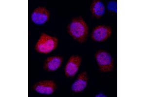 anti-DNA-Damage-Inducible Transcript 4 (DDIT4) (AA 1-50) antibody