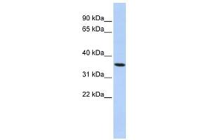 PAQR6 antibody used at 1 ug/ml to detect target protein. (PAQR6 Antikörper  (N-Term))