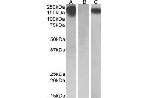 HEK293 lysate (10ug protein in RIPA buffer) overexpressing Human CSF1R with C-terminal MYC tag probed with ABIN571221 (0. (CSF1R Antikörper  (AA 700-710))