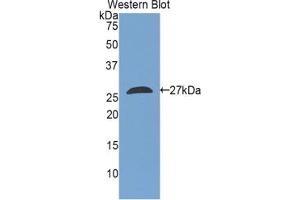 Detection of Recombinant TAZ, Rat using Polyclonal Antibody to Tafazzin (TAZ) (TAZ Antikörper  (AA 46-239))